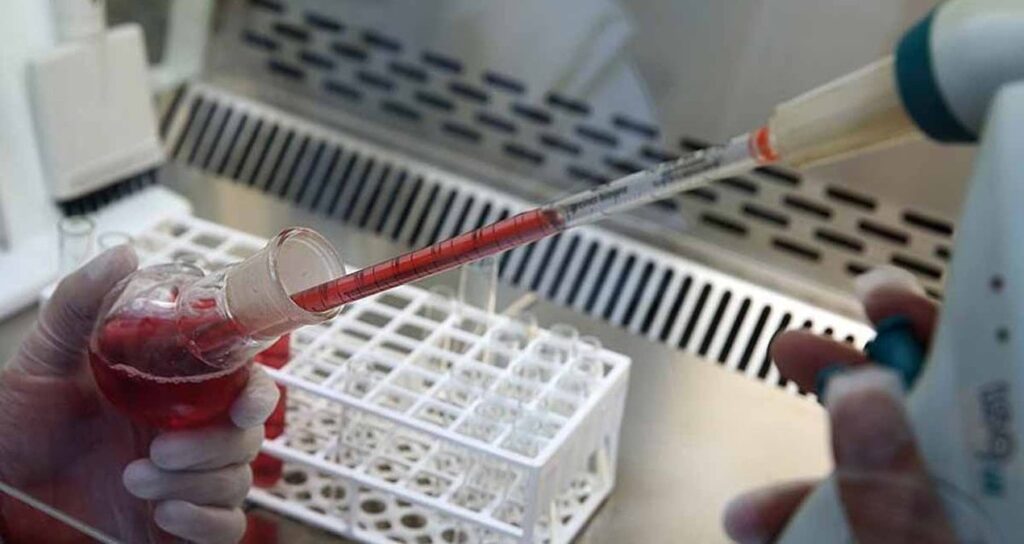 dunyada sadece 43 kiside var hem paha bicilemez bir hazine hem de buyuk bir risk altin kan 4b91WlGi